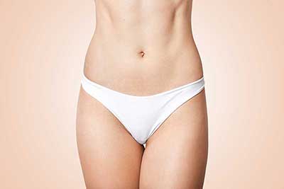 Labiaplasty